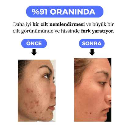 Aykar - Filtreli Duş Başlığı